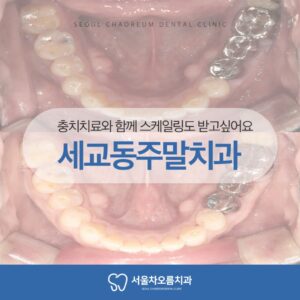 세교동주말치과 365서울차오름치과