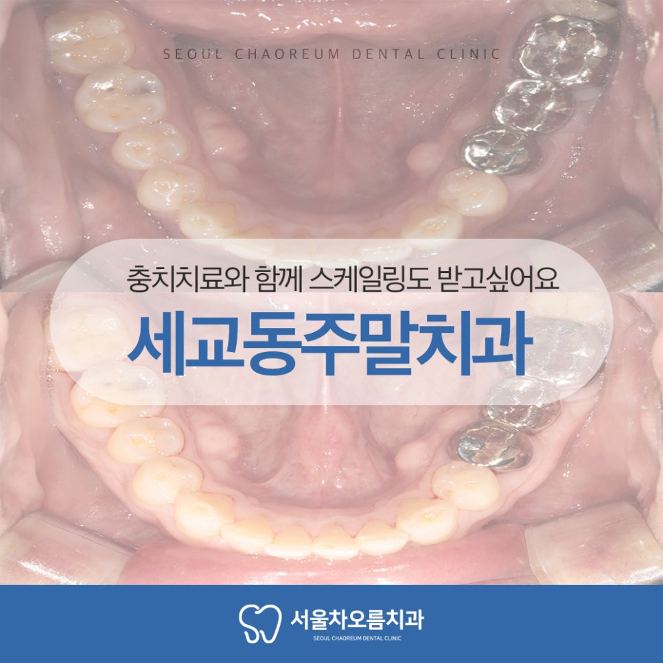 세교동주말치과 365서울차오름치과