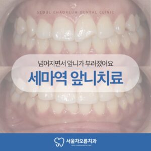 세마역 앞니치료 365서울차오름치과