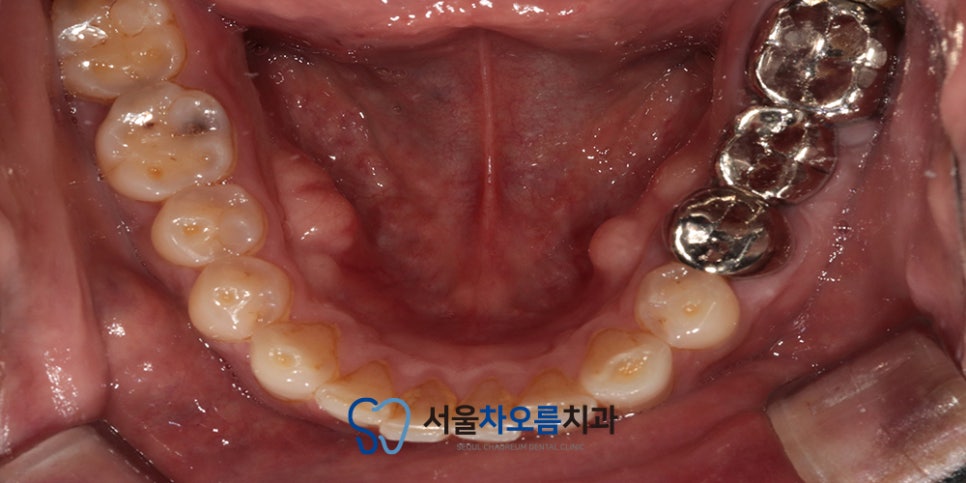 세교동주말치과 365서울차오름치과