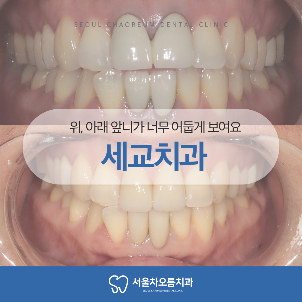 세교치과 