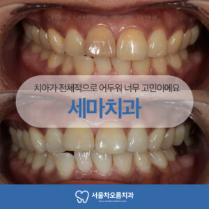세마치과