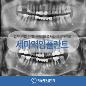 세마역임플란트