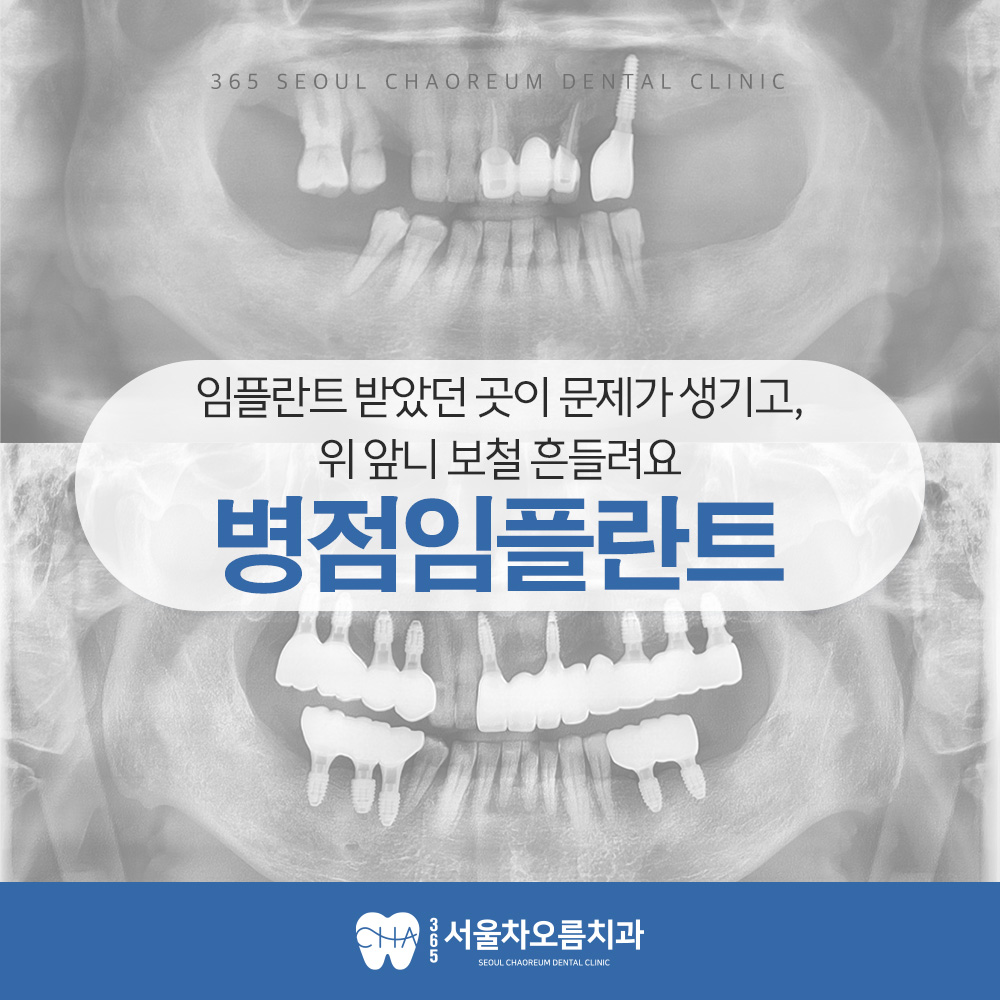 병점임플란트