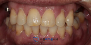 오산대역임플란트