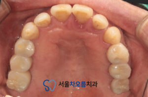 오산대역임플란트